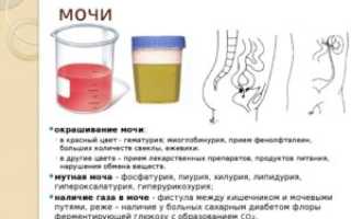 Цвет мочи при цистите у женщин