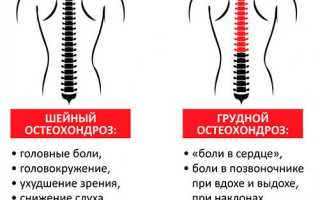 Головокружение при остеохондрозе шейного отдела