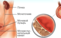Болит низ живота — причины