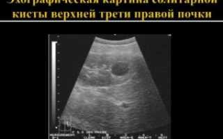 Мелкая киста паренхимы почки