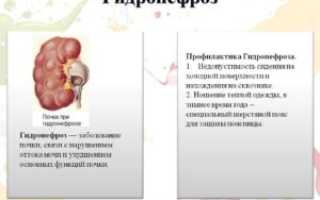 Нарушение оттока мочи из почки