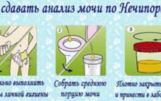 Анализ мочи по Нечипоренко
