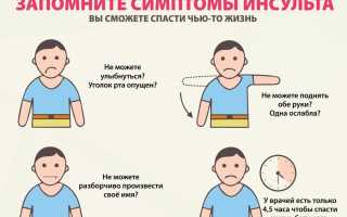 Обширный инсульт мозга