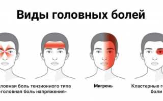 Кластерные боли в голове