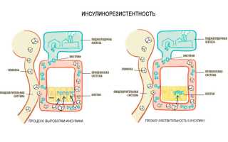 Диета при инсулинорезистентности, что можно и нельзя есть