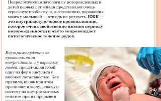 Последствия внутримозгового кровоизлияния у новорожденных