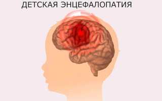 Детская энцефалопатия