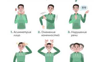 Симптомы и признаки всех видов инсульта