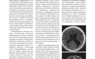 Гипертоническая форма энцефалопатии