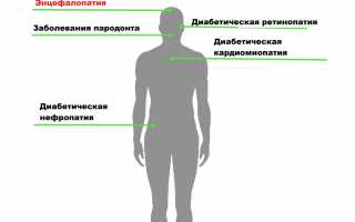 Признаки и проявление энцефалопатии