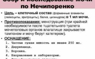 Моча по Нечипоренко