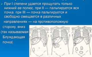 Опущение почки до 1 степени