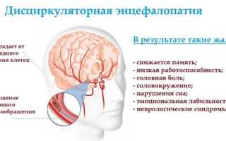 Дисциркуляторная энцефалопатия: все, что следует знать