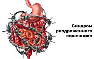 Диета при синдроме раздраженного кишечника (СРК)