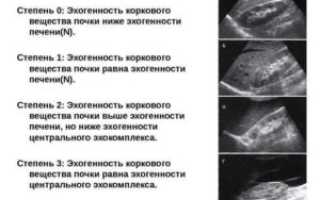 Утолщение стенок ЧЛС почек у детей