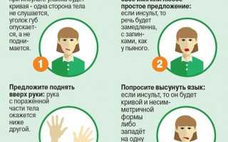 Симптомы инсульта у женщин