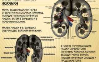 Почему расширяются чашечки в почках