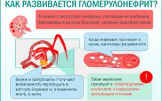 Температура при заболевании почек