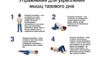 После инсульта недержание мочи