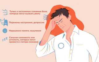 Астроцитома: симптомы, профилактика, лечение