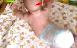 Как быть, если у новорожденного выпадают волосы?