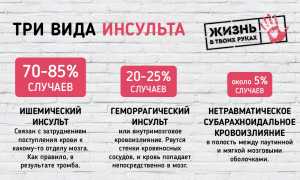 Инсульт глазных органов и его виды