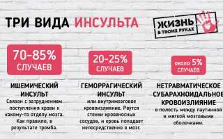 Инсульт глазных органов и его виды