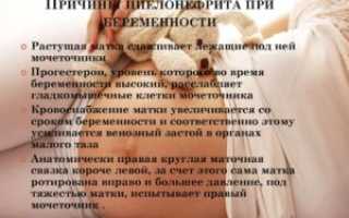 Можно ли беременеть при пиелонефрите