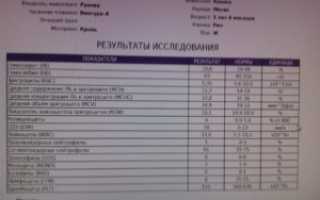 Анализ мочи при болях в почках