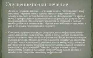 Лечение опущения почки 3 степени