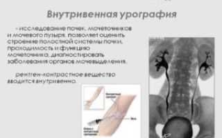 Как называется контрастное вещество для диагностики почек