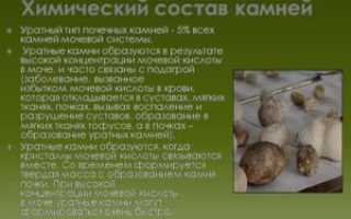 Определение состава камней в почках