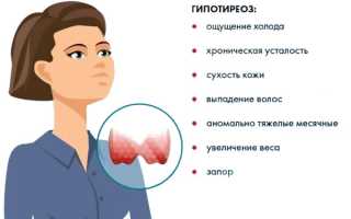 Диета при гипотиреозе, разрешенные и запрещенные продукты