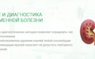 Профилактика и лечение мочекаменной болезни у мужчин