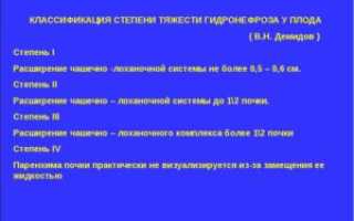 Классификация гидронефроза по степени