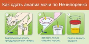 Анализ мочи по нечипоренко как собирать у беременных