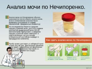 Анализ мочи по нечипоренко как собирать у беременных