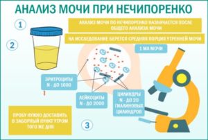 Анализ мочи по нечипоренко как собирать у беременных
