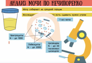 Анализ мочи по нечипоренко как собирать у беременных