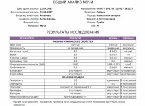 Анализ мочи при боли в почках