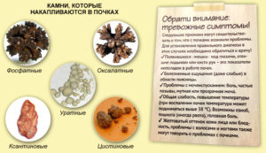 Боль в почках и рвота что это