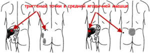 Болит левая почка и отдает в ногу
