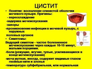 Болит низ живота где мочевой пузырь