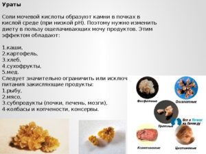 Что кушать когда камни в почках