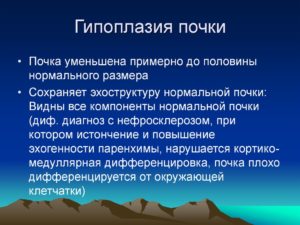 Что такое гипоплазия почки у взрослого человека