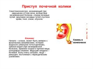Если приступ почек что делать