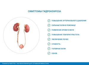 Гидронефроз 3 степени правой почки у ребенка