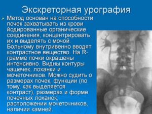 Как называется контрастное вещество для почек