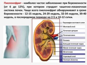 Как проверить почки при беременности