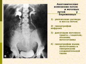 Как проверить почки при беременности